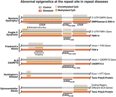 Genetic and Epigenetic Interplay Define Disease Onset and Severity in Repeat Diseases